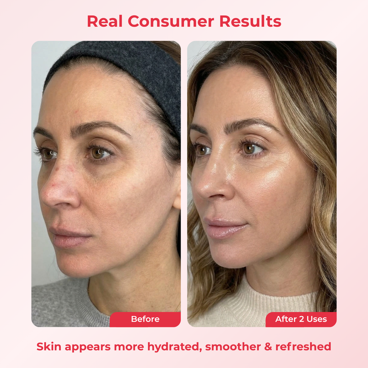 PDRN Deep Mask (4 Masks)